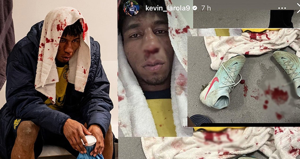 Skandal kararla Avrupa’ya veda! Kanlar içinde paylaştı